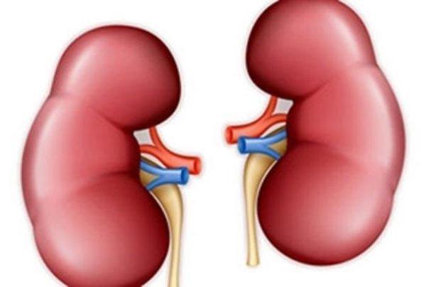 علائم سنگ کلیه را بشناسید علائم سنگ کلیه را بشناسید